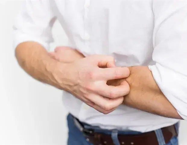 Common Allergy Drugs Fail to Ease Eczema Symptoms