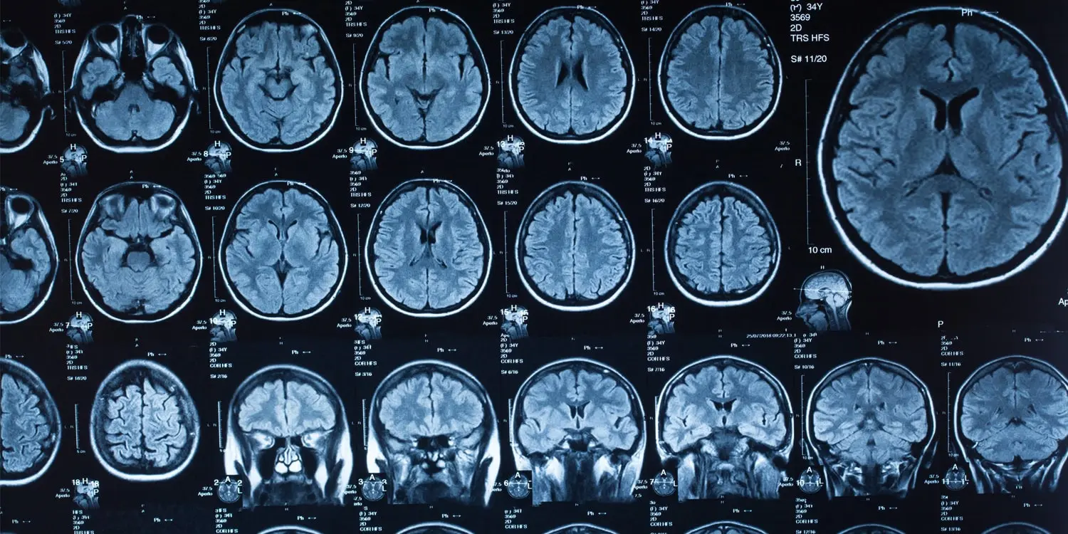Fine Particles Shape Young Brains